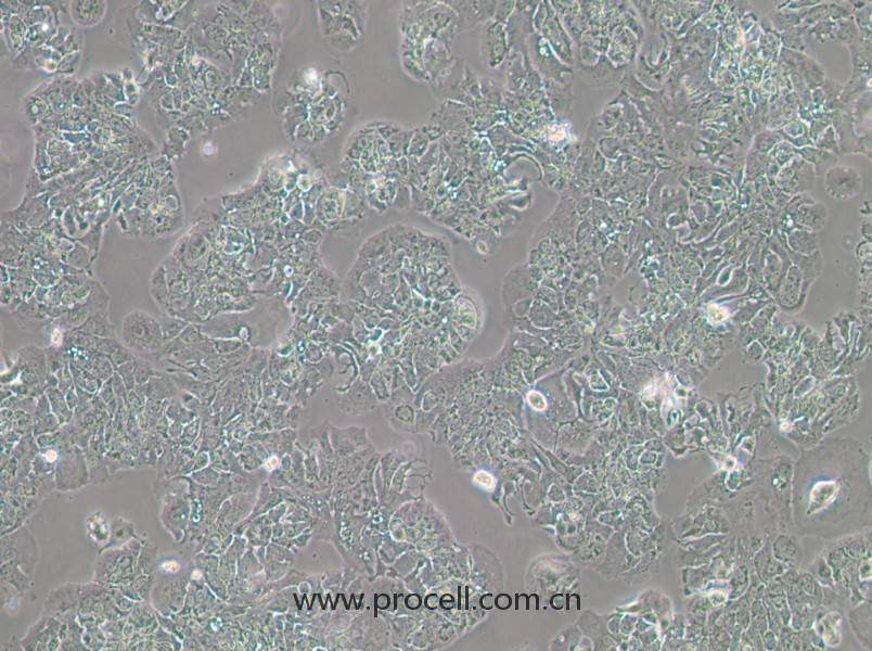 MDA-MB-415 (人乳腺癌細(xì)胞) (STR鑒定正確)