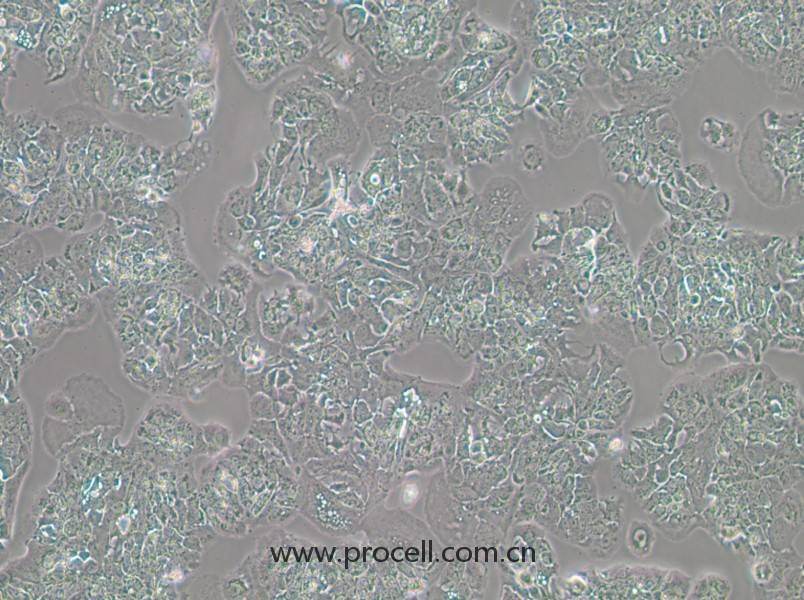 MDA-MB-415 (人乳腺癌細(xì)胞) (STR鑒定正確)