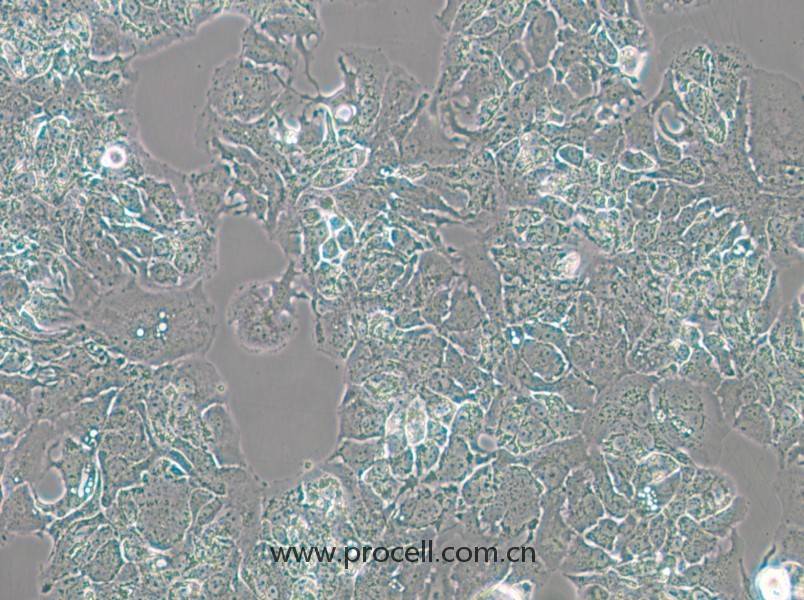 MDA-MB-415 (人乳腺癌細(xì)胞) (STR鑒定正確)