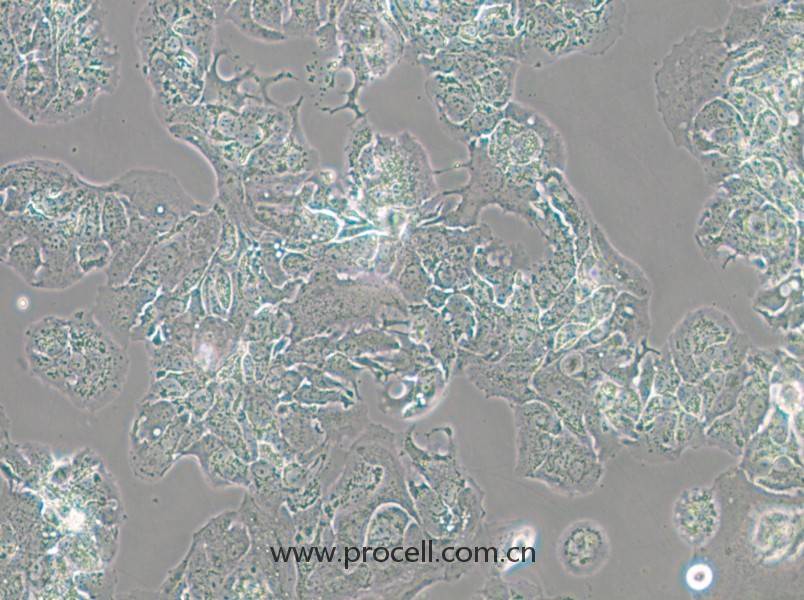 MDA-MB-415 (人乳腺癌細(xì)胞) (STR鑒定正確)