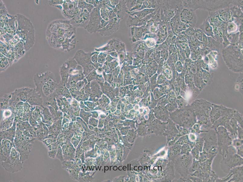 MDA-MB-415 (人乳腺癌細(xì)胞) (STR鑒定正確)