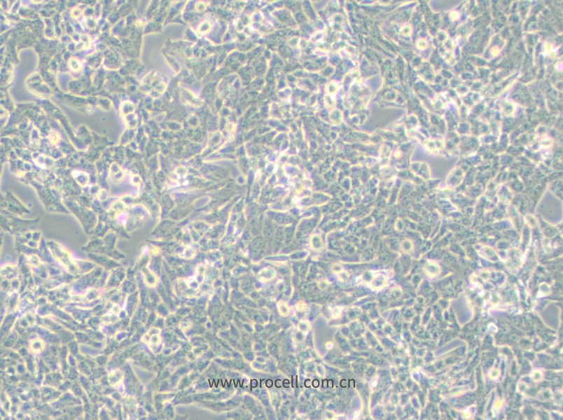NCI-H295R (人腎上腺皮質(zhì)腺癌細胞) (STR鑒定正確)