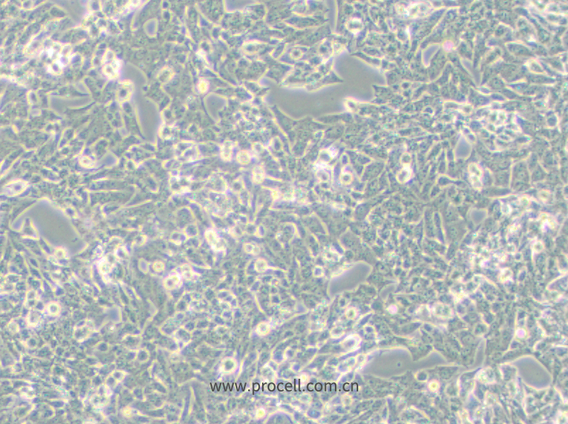 NCI-H295R (人腎上腺皮質(zhì)腺癌細胞) (STR鑒定正確)