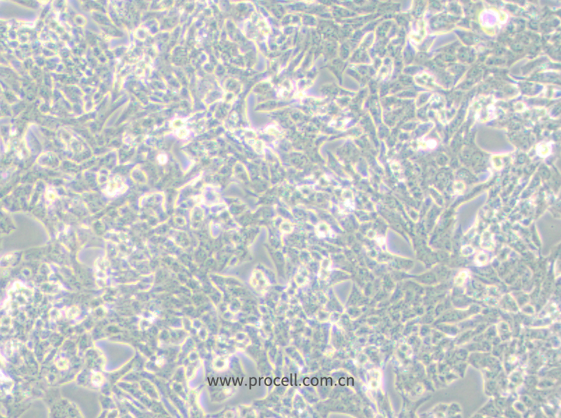 NCI-H295R (人腎上腺皮質(zhì)腺癌細胞) (STR鑒定正確)