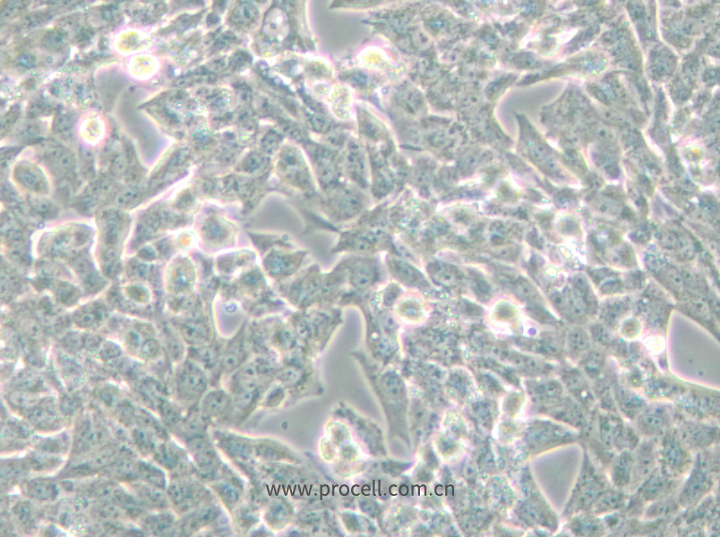 NCI-H295R (人腎上腺皮質(zhì)腺癌細胞) (STR鑒定正確)