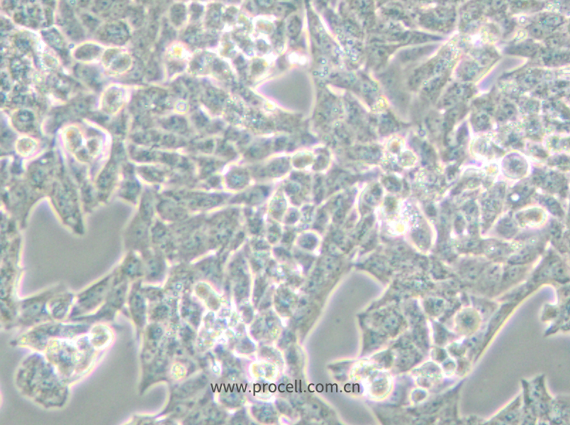 NCI-H295R (人腎上腺皮質(zhì)腺癌細胞) (STR鑒定正確)