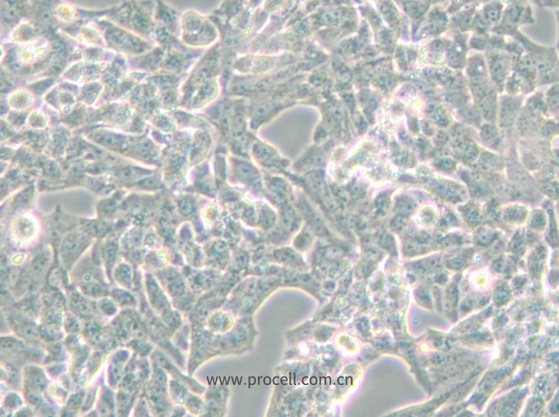 NCI-H295R (人腎上腺皮質(zhì)腺癌細胞) (STR鑒定正確)