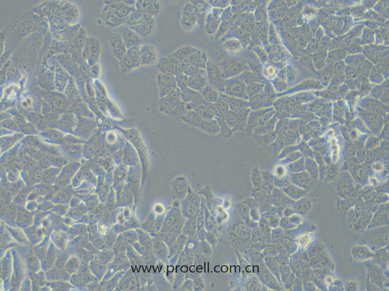 NCI-H358 (人非小細胞肺癌細胞) (STR鑒定正確)