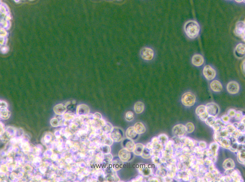 NCI-H524 (人小細胞肺癌細胞) (STR鑒定正確)