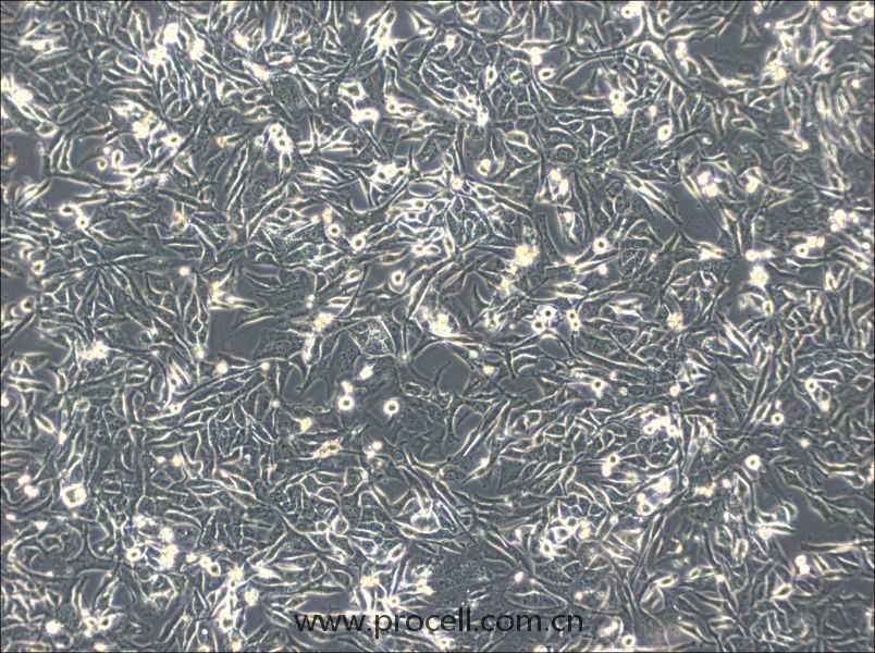 NCI-H596 (人肺腺鱗癌細(xì)胞) (STR鑒定正確）