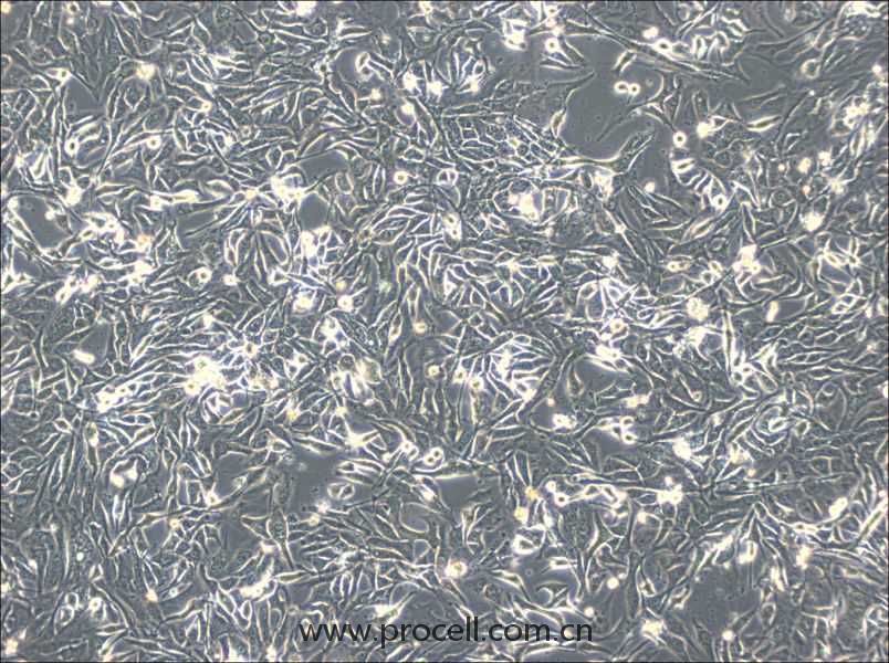 NCI-H596 (人肺腺鱗癌細(xì)胞) (STR鑒定正確）
