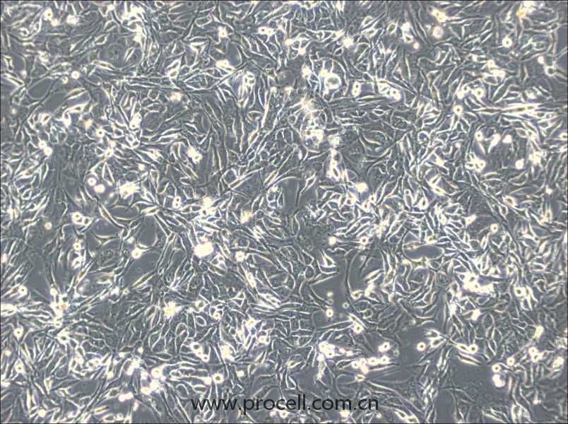 NCI-H596 (人肺腺鱗癌細(xì)胞) (STR鑒定正確）
