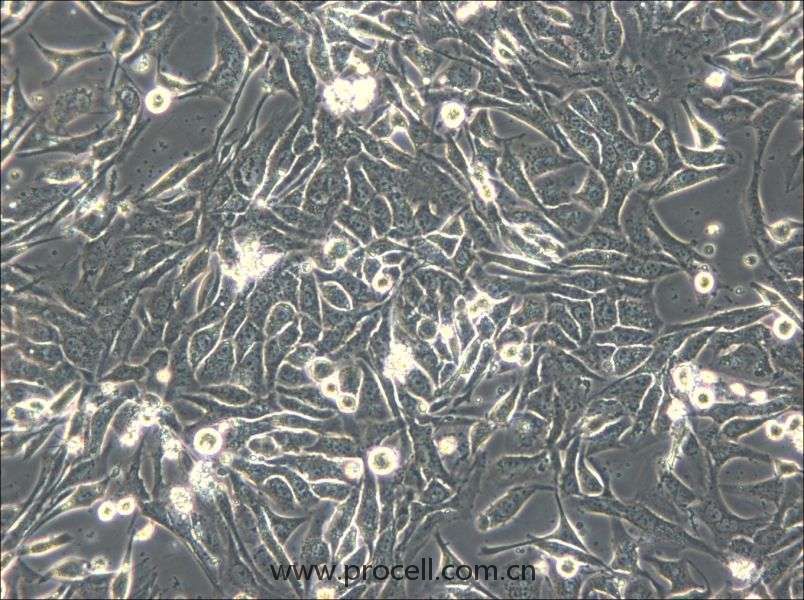 NCI-H596 (人肺腺鱗癌細(xì)胞) (STR鑒定正確）