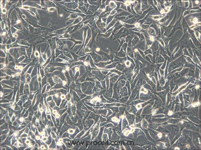 NCI-H596 (人肺腺鱗癌細(xì)胞) (STR鑒定正確）