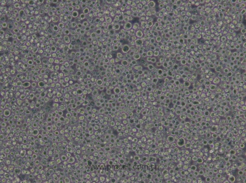 P3X63Ag8.653 (小鼠骨髓瘤細胞) (STR鑒定正確)