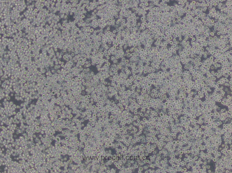 P3X63Ag8.653 (小鼠骨髓瘤細胞) (STR鑒定正確)