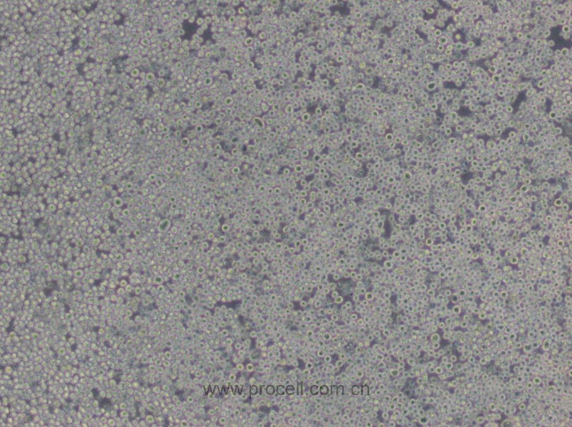 P3X63Ag8.653 (小鼠骨髓瘤細胞) (STR鑒定正確)