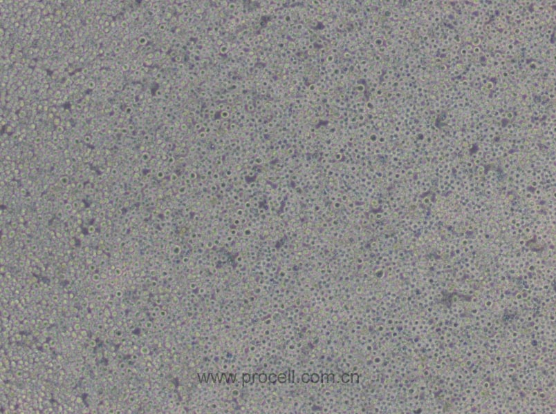 P3X63Ag8.653 (小鼠骨髓瘤細胞) (STR鑒定正確)