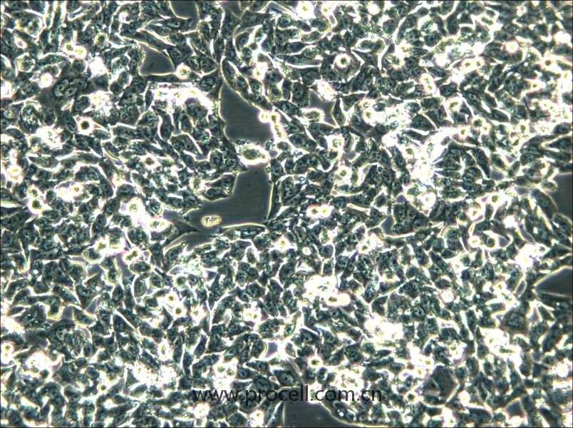 SK-CO-1 (人結(jié)直腸腺癌細胞) (STR鑒定正確）