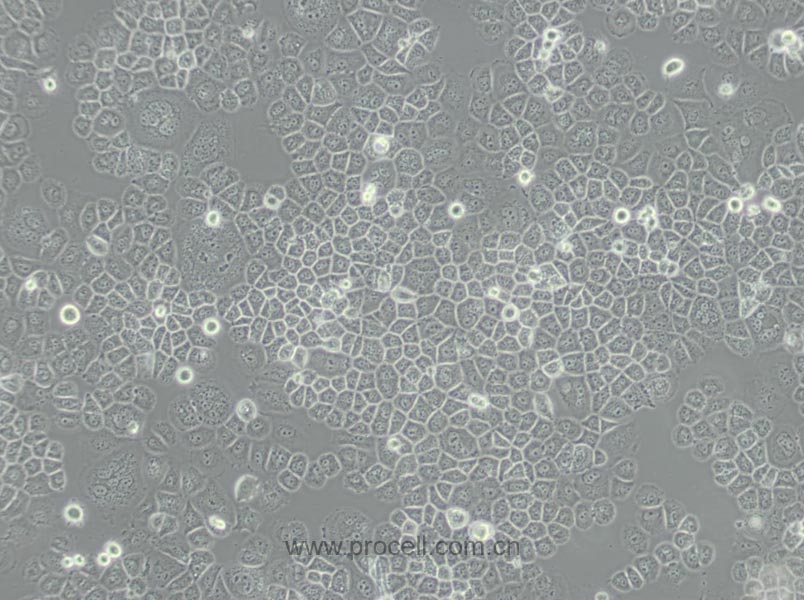 SW-13 (人腎上腺皮質(zhì)小細胞癌細胞) (STR鑒定正確)