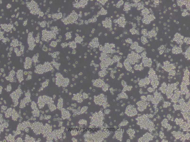 L5178Y TK+/- clone(3.7.2C) (小鼠淋巴瘤細(xì)胞) (STR鑒定正確)