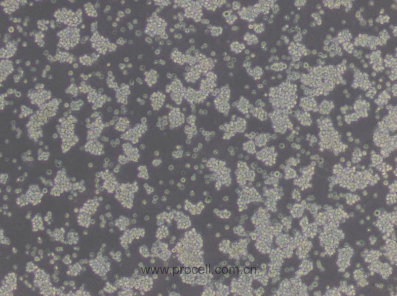 L5178Y TK+/- clone(3.7.2C) (小鼠淋巴瘤細(xì)胞) (STR鑒定正確)