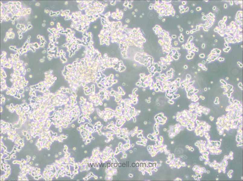 WERI-Rb-1 (人視網膜神經膠質瘤細胞) (STR鑒定正確)