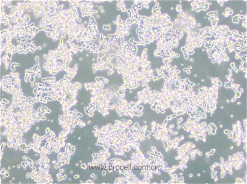 WERI-Rb-1 (人視網膜神經膠質瘤細胞) (STR鑒定正確)