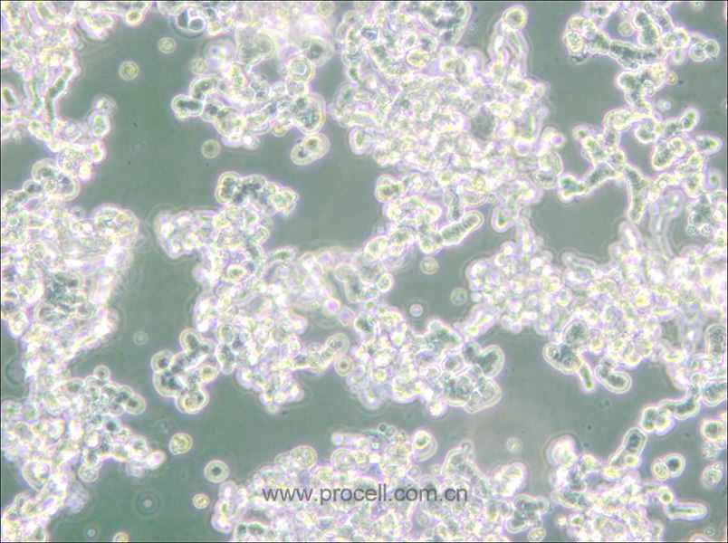 WERI-Rb-1 (人視網膜神經膠質瘤細胞) (STR鑒定正確)