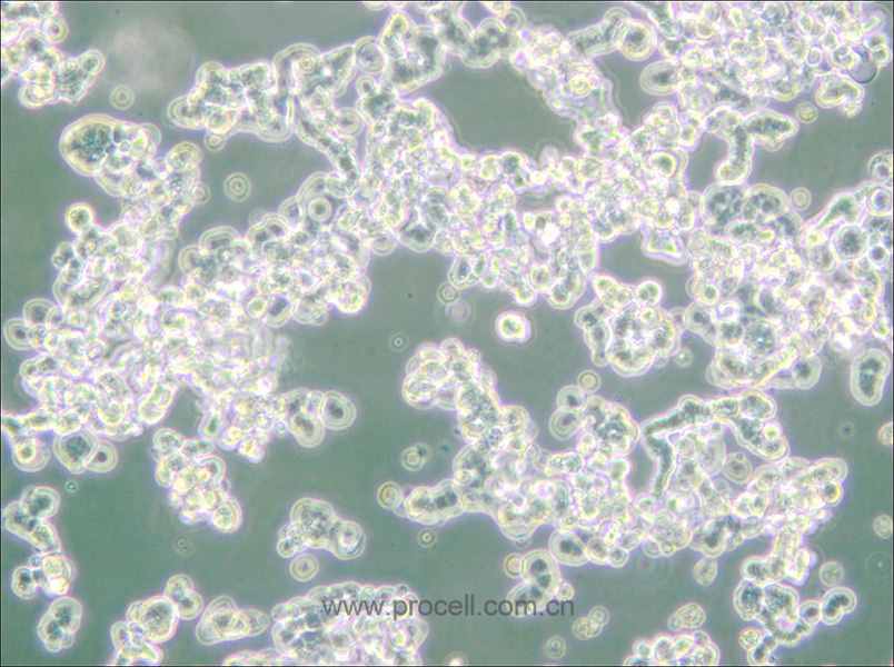 WERI-Rb-1 (人視網膜神經膠質瘤細胞) (STR鑒定正確)