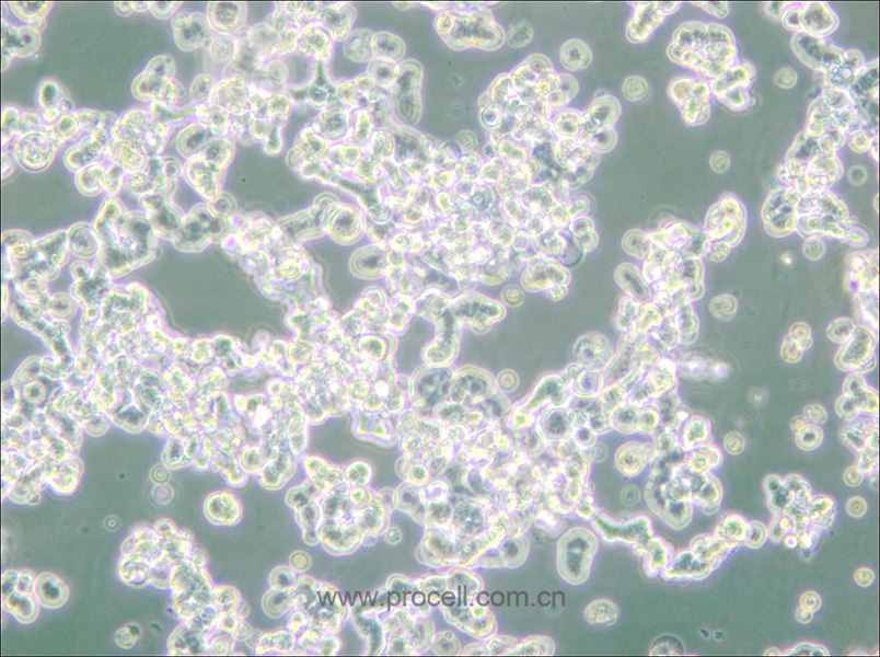 WERI-Rb-1 (人視網膜神經膠質瘤細胞) (STR鑒定正確)