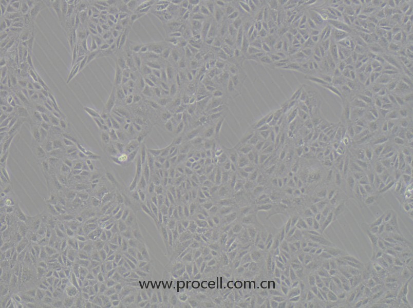 CV-1 [Part of the Wistar Special Collection] (非洲綠猴腎細(xì)胞)(種屬鑒定正確)