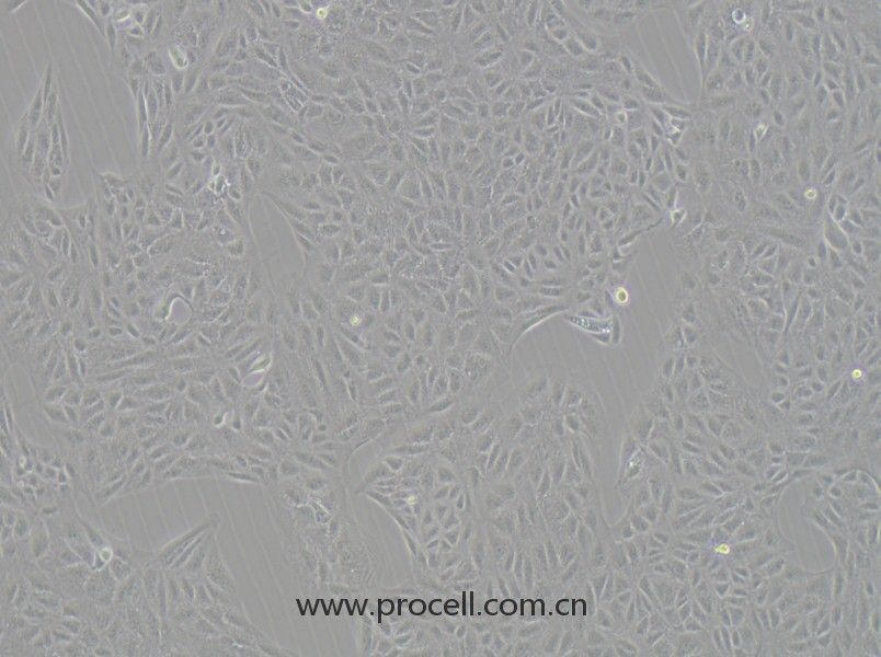 CV-1 [Part of the Wistar Special Collection] (非洲綠猴腎細(xì)胞)(種屬鑒定正確)