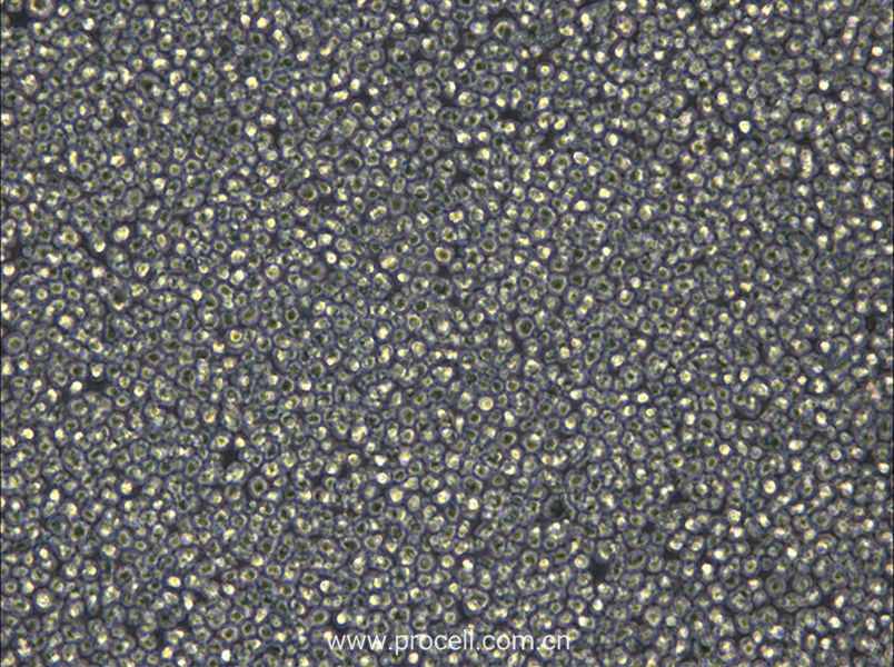 NCI-H929 (人骨髓瘤細(xì)胞) (STR鑒定正確)