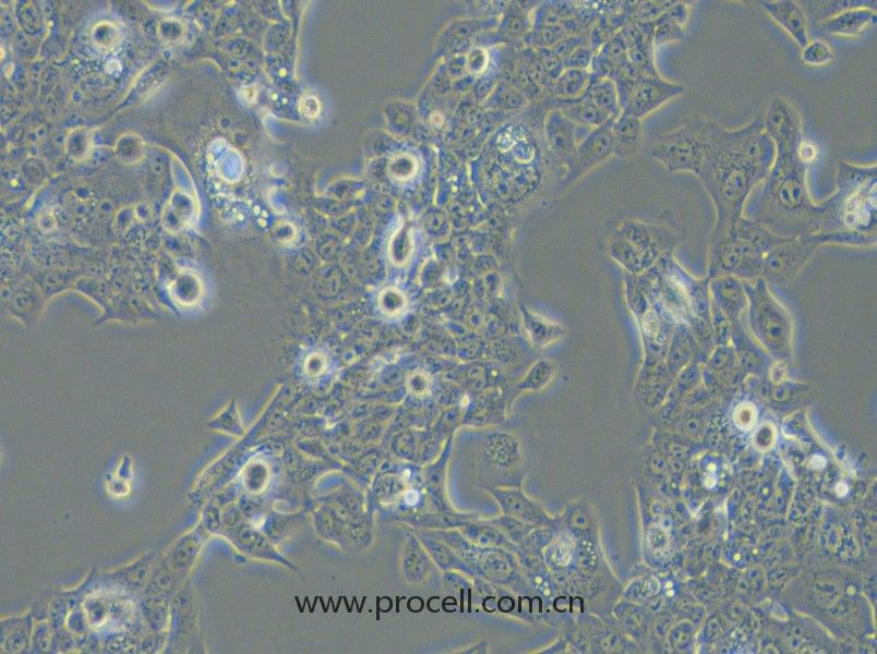NCI-H441 (人肺腺癌細胞) (STR鑒定正確)