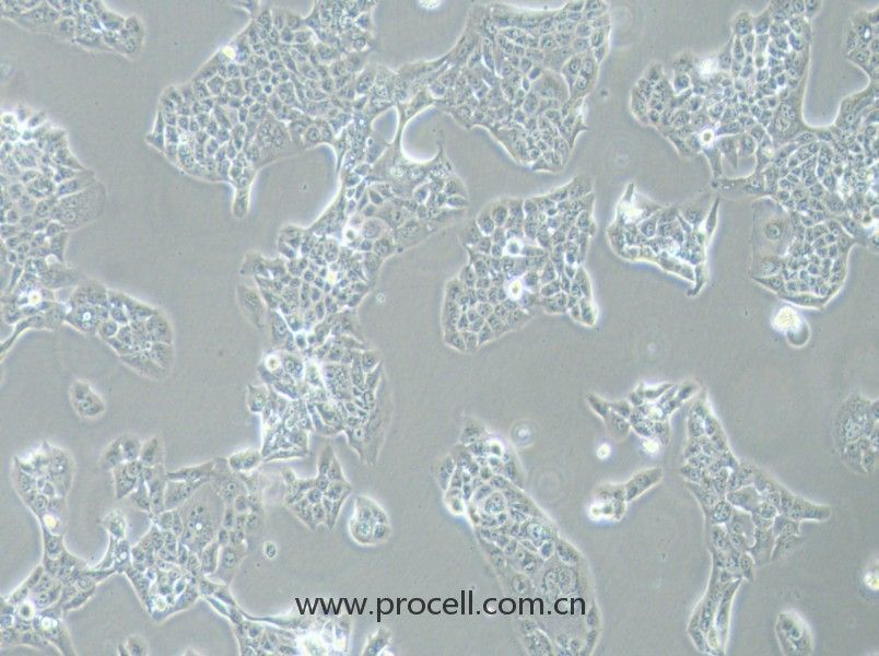 NCI-H441 (人肺腺癌細胞) (STR鑒定正確)