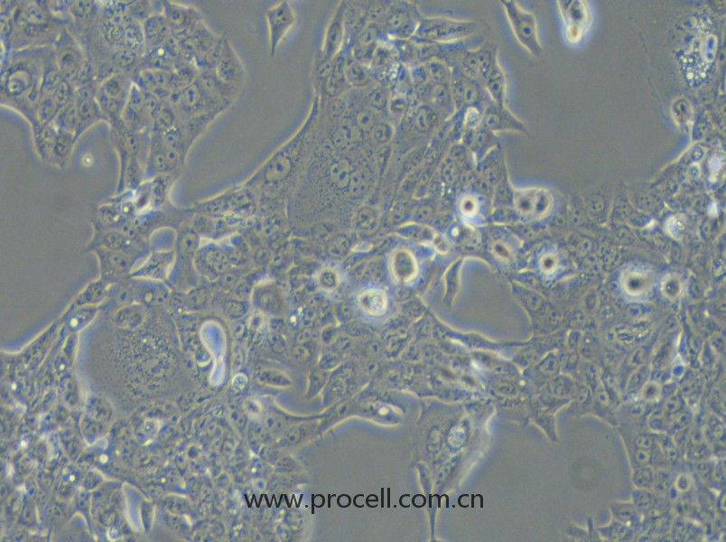 NCI-H441 (人肺腺癌細胞) (STR鑒定正確)