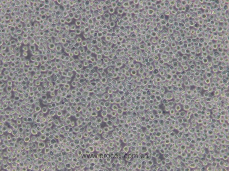 Hi-five (BTI-TN-5B1-4) (昆蟲細胞)(暫不出售）
