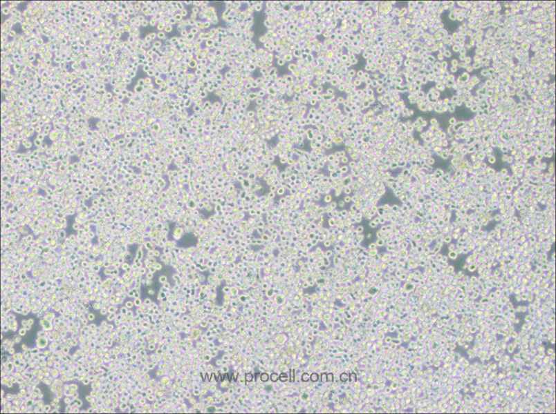 RPMI 8226 (人多發(fā)性骨髓瘤外周血B淋巴細(xì)胞) (STR鑒定正確)