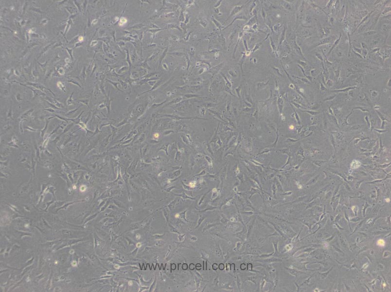 HULEC-5a (人肺微血管內(nèi)皮細胞) (STR鑒定正確)(暫不供應(yīng))(暫不出售）
