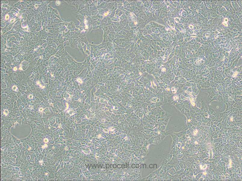 NCI-H2228 [H2228; H-2228] (人肺癌細(xì)胞) (STR鑒定正確)
