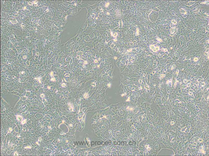NCI-H2228 [H2228; H-2228] (人肺癌細(xì)胞) (STR鑒定正確)