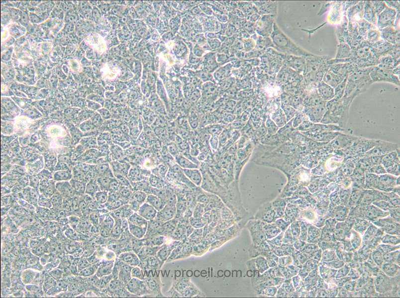 NCI-H2228 [H2228; H-2228] (人肺癌細(xì)胞) (STR鑒定正確)