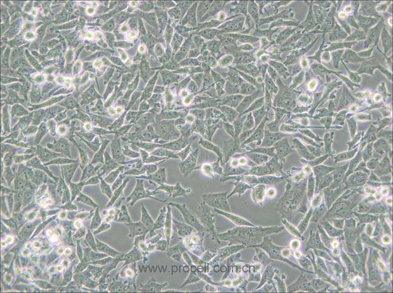 PaTu 8988t (人胰腺癌細胞) (STR鑒定正確)