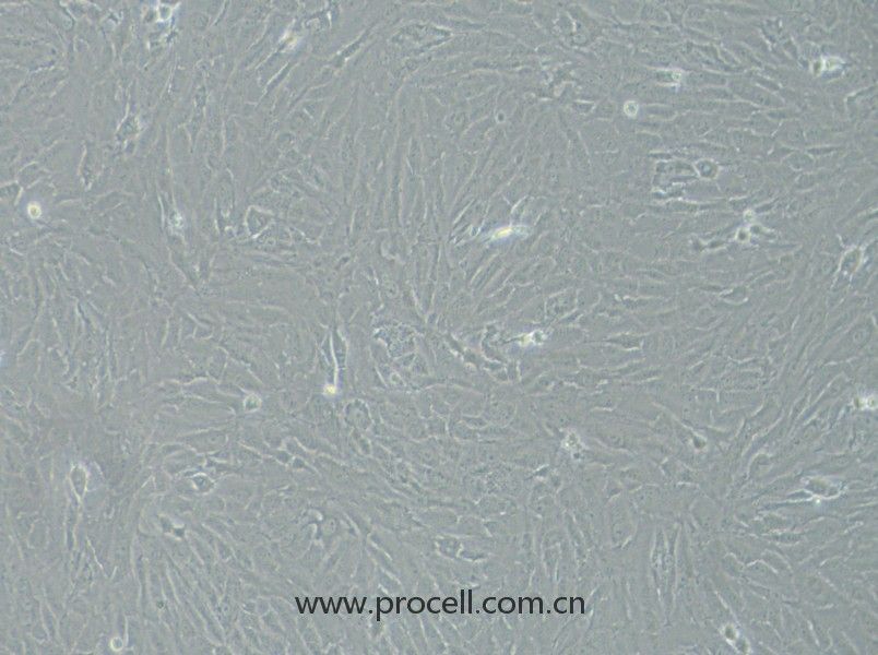 KGN（人卵巢顆粒細(xì)胞）（STR鑒定正確）