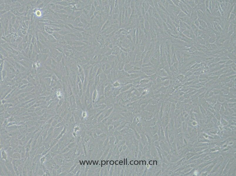 KGN（人卵巢顆粒細(xì)胞）（STR鑒定正確）