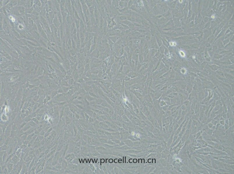 KGN（人卵巢顆粒細(xì)胞）（STR鑒定正確）