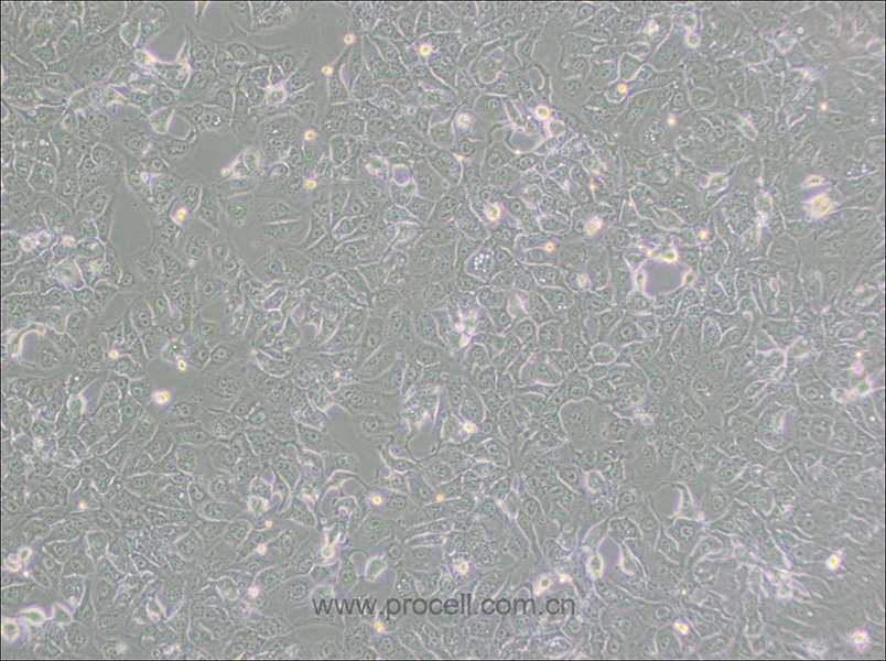 BHT101 (人甲狀腺癌細(xì)胞(未分化)) (STR鑒定正確)