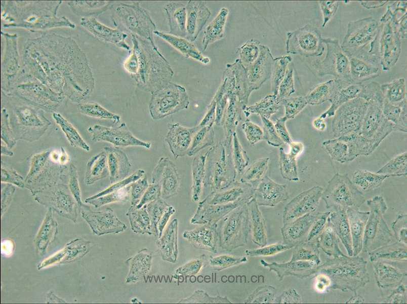 TCCSUP (人膀胱癌細(xì)胞) (STR鑒定正確)