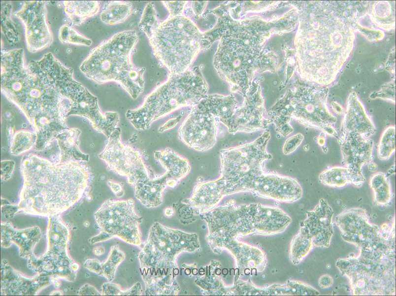 SW948 (人結(jié)腸腺癌細(xì)胞) (STR鑒定正確)